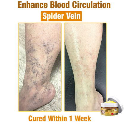 🐝 flysmus® Bee Venom Comprehensive Cream