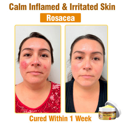 🐝 flysmus® Bee Venom Comprehensive Cream