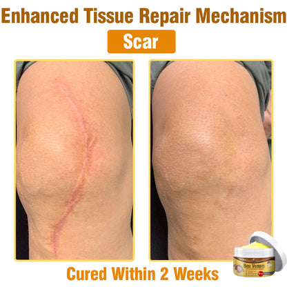 🐝 flysmus® Bee Venom Comprehensive Cream