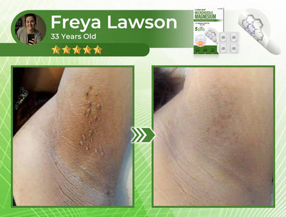 🔥Final 3 Hours: 80% OFF - LBMLBM® Magnesium MicroNeedle Precise Remove Skin Tag Patches
