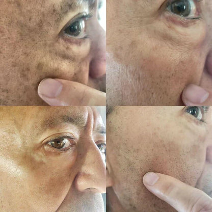 ✨Seurico™ Rapid Dark Spot Eraser – Melanin Correcting Facial Serum🔥