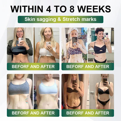 Final 3 Hours: 80% OFF✅ LBMLBM® SMGT-GLP-1 Collagen Nano Microneedle Patch (Clinically Proven & Suitable for All Ages)