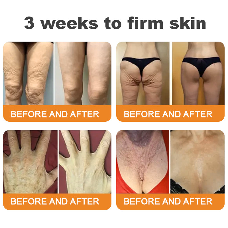 Made and Shipped from USA 🥑 LipMaps® Bee Venom Skin Restoration Cream ⏰ LAST DAY 80% OFF