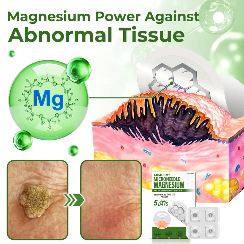 🔥Final 3 Hours: 80% OFF - LBMLBM® Magnesium MicroNeedle Precise Remove Skin Tag Patches