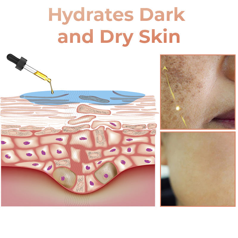 ✨Seurico™ Rapid Dark Spot Eraser – Melanin Correcting Facial Serum🔥