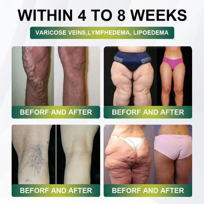 Final 3 Hours: 80% OFF✅ LBMLBM® SMGT-GLP-1 Collagen Nano Microneedle Patch (Clinically Proven & Suitable for All Ages)