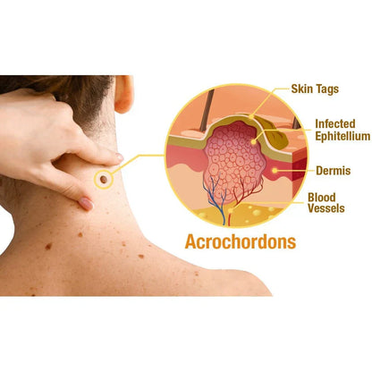 🐝LOVILDS™ TagRecede Bee Venom Treatment Spray