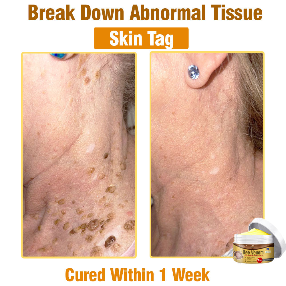 🐝 flysmus® Bee Venom Comprehensive Cream