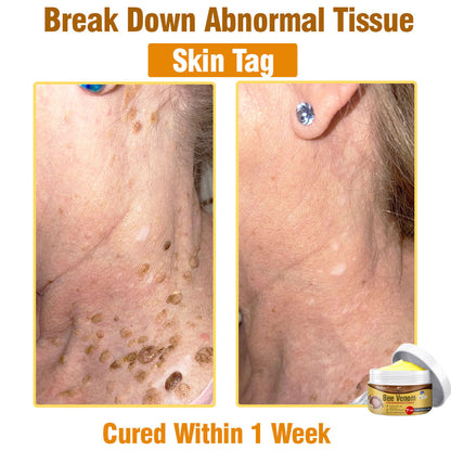 🐝 flysmus® Bee Venom Comprehensive Cream