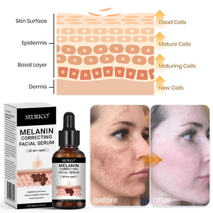 ✨Seurico™ Rapid Dark Spot Eraser – Melanin Correcting Facial Serum🔥
